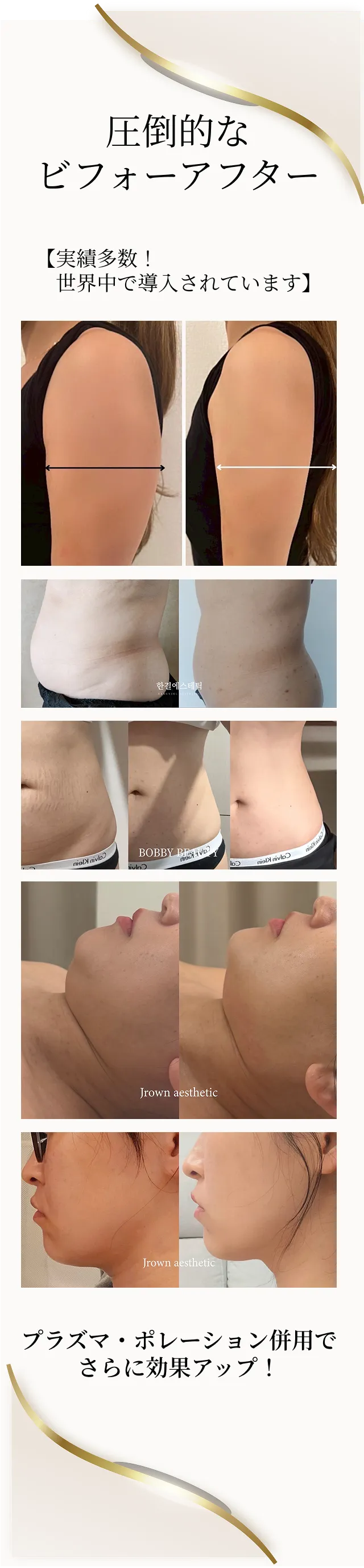 イオン化ミネラル溶液